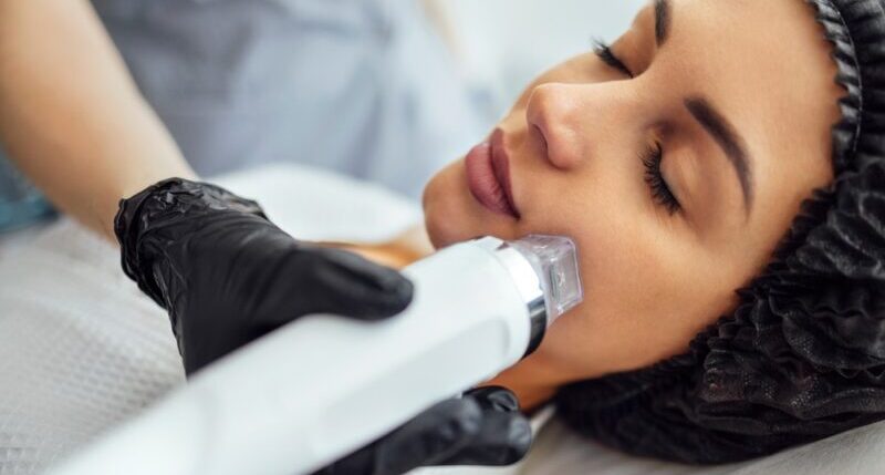 Microneedle,Rf,Lifting,Procedure.,Hardware,Cosmetology.,Beautician,Conducts,A,Facial